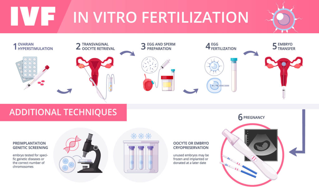 mediterra_assistance_ivf_invitro_fertilization_steps